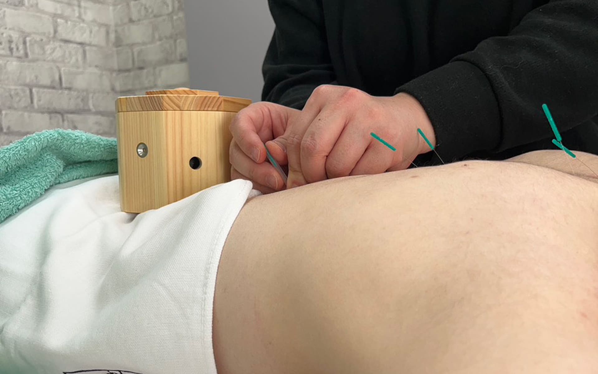 施術の流れについて