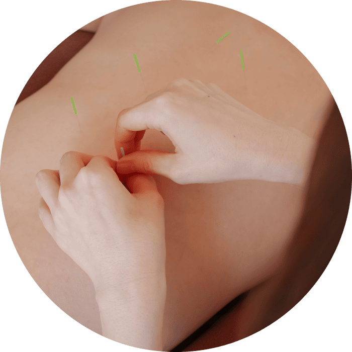 症状や体調に合わせて施術内容を調整します