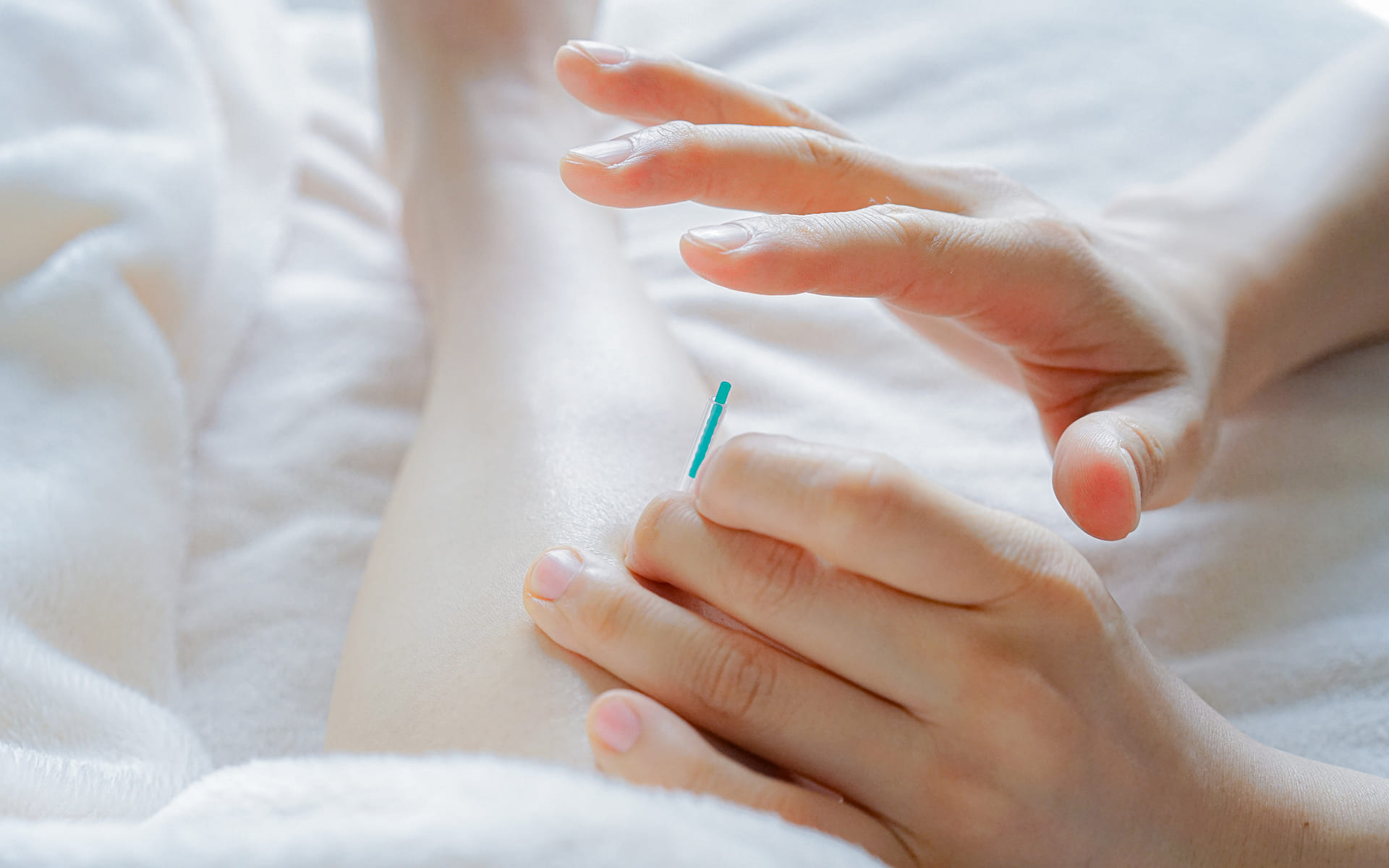 根本改善を目指す全身バランスの鍼灸治療